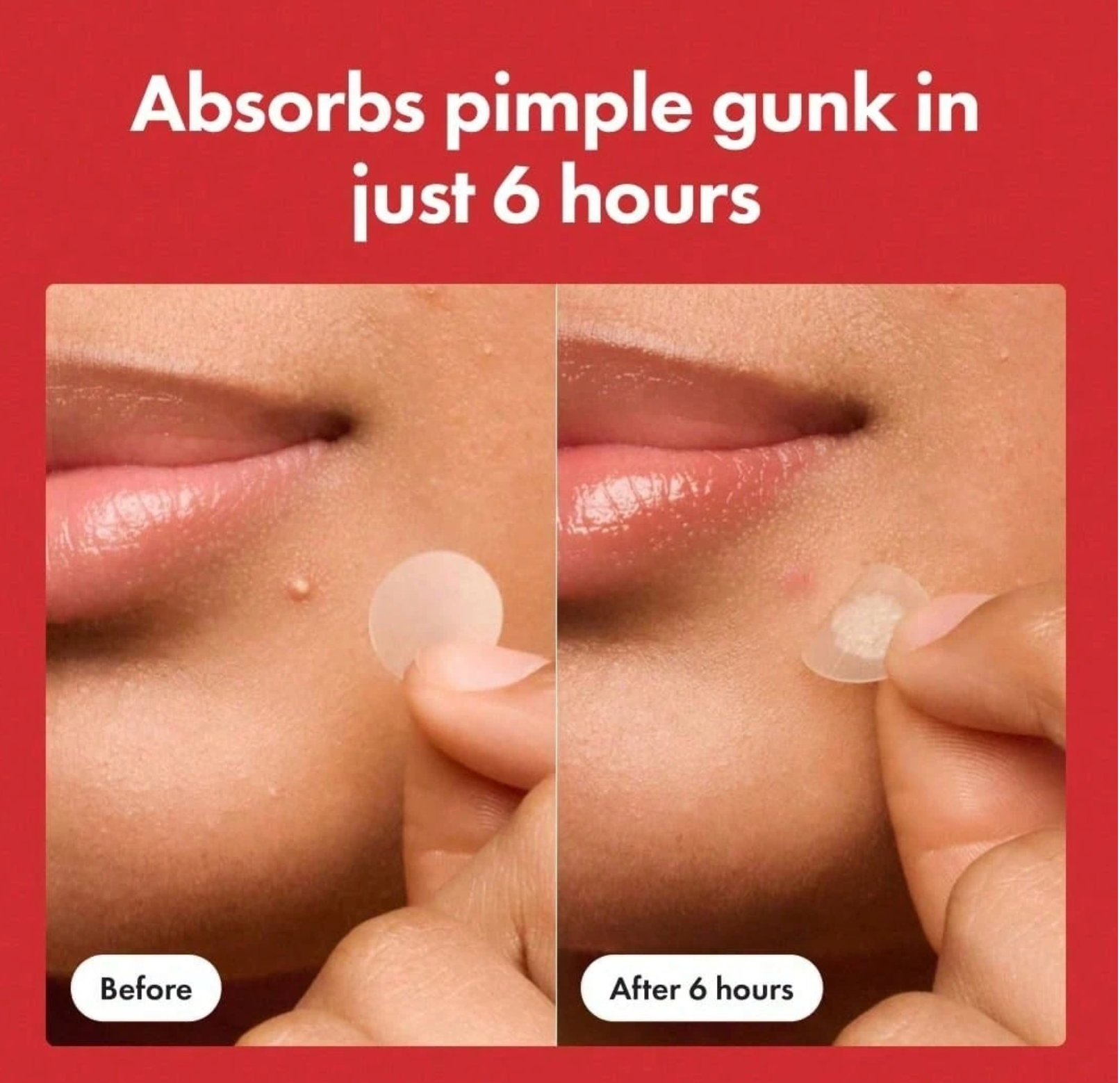 Before and after showing a pimple being absorbed by a patch on skin with a red background.